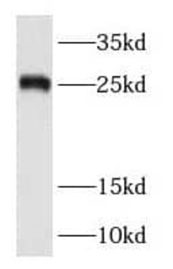 RAB38 Antibody - BSA Free, Novus Biologicals 100 &mu;g | Buy Online | Novus Biologicals | Fisher Scientific