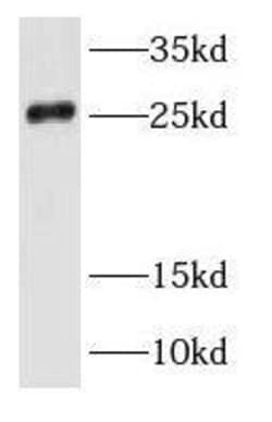 RAB35 Antibody - BSA Free, Novus Biologicals 100 &mu;g | Buy Online | Novus Biologicals | Fisher Scientific