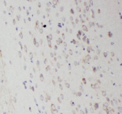 RAB35 Antibody - BSA Free, Novus Biologicals 100 &mu;g | Buy Online | Novus Biologicals | Fisher Scientific
