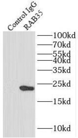 RAB35 Antibody - BSA Free, Novus Biologicals 100 &mu;g | Buy Online | Novus Biologicals | Fisher Scientific