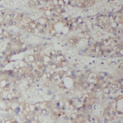 RAB14 Antibody - BSA Free, Novus Biologicals 100 &mu;g | Buy Online | Novus Biologicals | Fisher Scientific