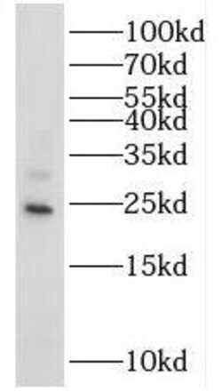 RAB14 Antibody - BSA Free, Novus Biologicals 100 &mu;g | Buy Online | Novus Biologicals | Fisher Scientific
