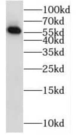 RAB11FIP2 Antibody - BSA Free, Novus Biologicals 100 &mu;g | Buy Online | Novus Biologicals | Fisher Scientific