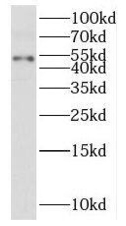 PUS3 Antibody - BSA Free, Novus Biologicals 100 &mu;g | Buy Online | Novus Biologicals | Fisher Scientific
