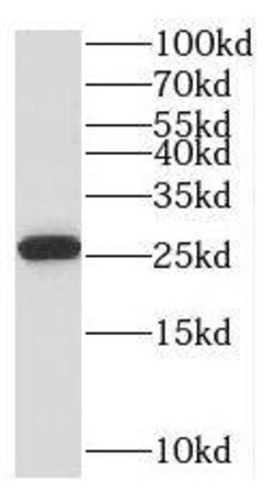PTTG1IP Antibody - BSA Free, Novus Biologicals 100 &mu;g | Buy Online | Novus Biologicals | Fisher Scientific