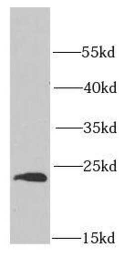 Proteasome beta 1 Antibody - BSA Free, Novus Biologicals 100 &mu;g | Buy Online | Novus Biologicals | Fisher Scientific