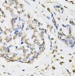 Proteasome beta 1 Antibody - BSA Free, Novus Biologicals 100 &mu;g | Buy Online | Novus Biologicals | Fisher Scientific