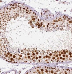 PRPF6 Antibody - BSA Free, Novus Biologicals 100 &mu;g | Buy Online | Novus Biologicals | Fisher Scientific