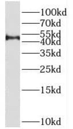 PRMT8 Antibody - BSA Free, Novus Biologicals 100 &mu;g | Buy Online | Novus Biologicals | Fisher Scientific