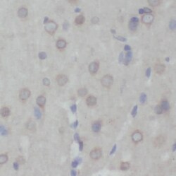 PRMT8 Antibody - BSA Free, Novus Biologicals 100 &mu;g | Buy Online | Novus Biologicals | Fisher Scientific