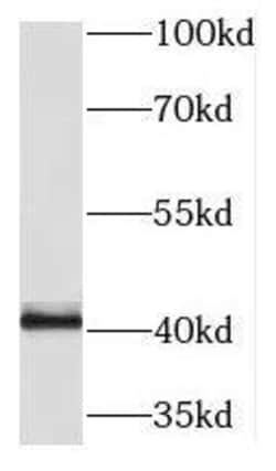 PRKX Antibody - BSA Free, Novus Biologicals 100 &mu;g | Buy Online | Novus Biologicals | Fisher Scientific
