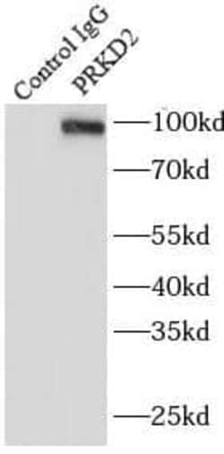 Protein Kinase D2 Antibody - BSA Free, Novus Biologicals 100 &mu;g | Buy Online | Novus Biologicals | Fisher Scientific