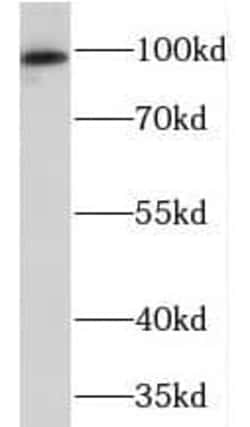 Protein Kinase D2 Antibody - BSA Free, Novus Biologicals 100 &mu;g | Buy Online | Novus Biologicals | Fisher Scientific