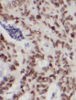 Protein Kinase D2 Antibody - BSA Free, Novus Biologicals 100 &mu;g | Buy Online | Novus Biologicals | Fisher Scientific