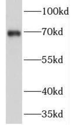 PRICKLE3 Antibody - BSA Free, Novus Biologicals 100 &mu;g | Buy Online | Novus Biologicals | Fisher Scientific