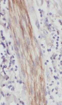 PX19 Antibody - BSA Free, Novus Biologicals 100 &mu;g | Buy Online | Novus Biologicals | Fisher Scientific