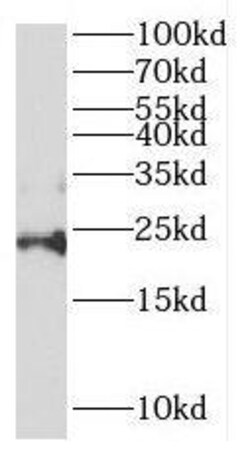 PPPDE1 Antibody - BSA Free, Novus Biologicals 100 &mu;g | Buy Online | Novus Biologicals | Fisher Scientific