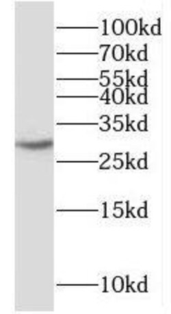PPIL6 Antibody - BSA Free, Novus Biologicals 100 &mu;g | Buy Online | Novus Biologicals | Fisher Scientific