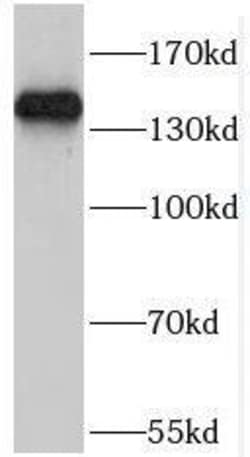 POM121 Antibody - BSA Free, Novus Biologicals 100 &mu;g | Buy Online | Novus Biologicals | Fisher Scientific