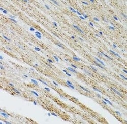 Myotilin Antibody - BSA Free, Novus Biologicals 100 &mu;g | Buy Online | Novus Biologicals | Fisher Scientific