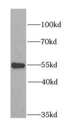 Myotilin Antibody - BSA Free, Novus Biologicals 100 &mu;g | Buy Online | Novus Biologicals | Fisher Scientific