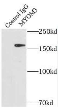 MYOM3 Antibody - BSA Free, Novus Biologicals 100 &mu;g | Buy Online | Novus Biologicals | Fisher Scientific
