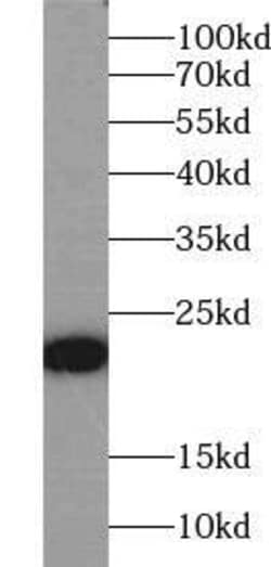 Fast skeletal myosin light chain 2 Antibody - BSA Free, Novus Biologicals 100 &mu;g | Buy Online | Novus Biologicals | Fisher Scientific