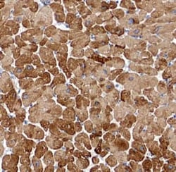 MYL7 Antibody - BSA Free, Novus Biologicals 100 &mu;g | Buy Online | Novus Biologicals | Fisher Scientific