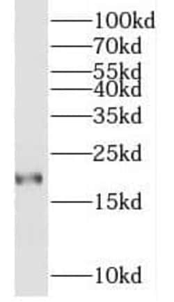 MYL7 Antibody - BSA Free, Novus Biologicals 100 &mu;g | Buy Online | Novus Biologicals | Fisher Scientific