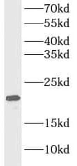 MYL4 Antibody - BSA Free, Novus Biologicals 100 &mu;g; Unconjugated:Antibodies,