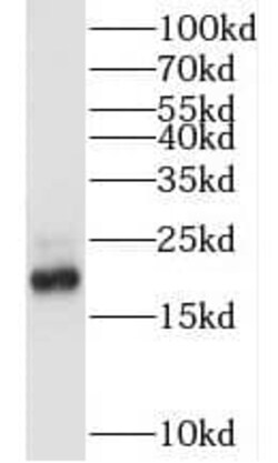 MRCL3 Antibody - BSA Free, Novus Biologicals 100 &mu;g | Buy Online | Novus Biologicals | Fisher Scientific