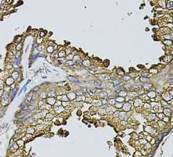 Fast skeletal myosin light chain 1 Antibody - BSA Free, Novus Biologicals 100 &mu;g | Buy Online | Novus Biologicals | Fisher Scientific