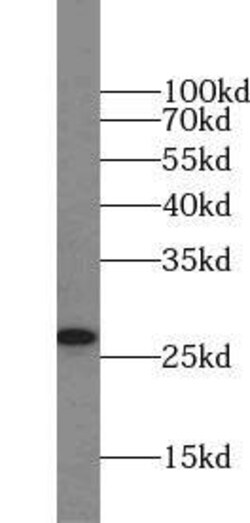 Fast skeletal myosin light chain 1 Antibody - BSA Free, Novus Biologicals 100 &mu;g | Buy Online | Novus Biologicals | Fisher Scientific