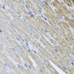 Metaxin-2 Antibody - BSA Free, Novus Biologicals 100 &mu;g | Buy Online | Novus Biologicals | Fisher Scientific