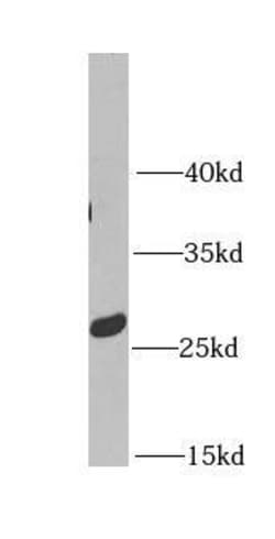 Metaxin-2 Antibody - BSA Free, Novus Biologicals 100 &mu;g | Buy Online | Novus Biologicals | Fisher Scientific