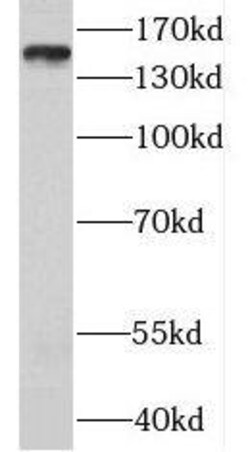 MTMR3 Antibody - BSA Free, Novus Biologicals 100 &mu;g | Buy Online | Novus Biologicals | Fisher Scientific