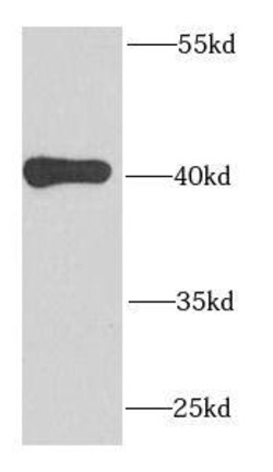 MRPS22 Antibody - BSA Free, Novus Biologicals 100 &mu;g | Buy Online | Novus Biologicals | Fisher Scientific