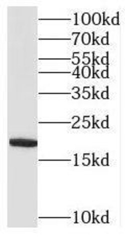 MRPL52 Antibody - BSA Free, Novus Biologicals 100 &mu;g | Buy Online | Novus Biologicals | Fisher Scientific