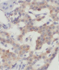 MRPL14 Antibody - BSA Free, Novus Biologicals 100 &mu;g | Buy Online | Novus Biologicals | Fisher Scientific