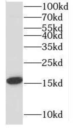 MRPL14 Antibody - BSA Free, Novus Biologicals 100 &mu;g | Buy Online | Novus Biologicals | Fisher Scientific