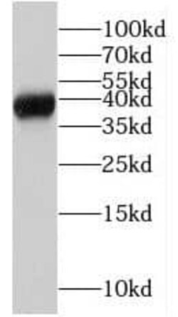 MRM1 Antibody - BSA Free, Novus Biologicals 100 &mu;g | Buy Online | Novus Biologicals | Fisher Scientific