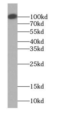mpp8 Antibody - BSA Free, Novus Biologicals 100 &mu;g | Buy Online | Novus Biologicals | Fisher Scientific