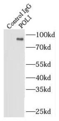 DNA Polymerase iota Antibody - BSA Free, Novus Biologicals 100 &mu;g | Buy Online | Novus Biologicals | Fisher Scientific