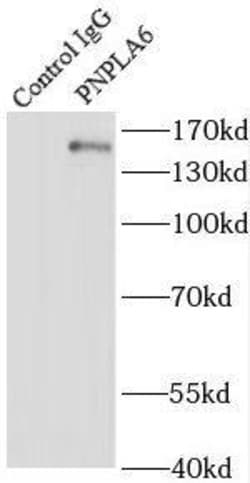 PNPLA6 Antibody - BSA Free, Novus Biologicals 100 &mu;g | Buy Online | Novus Biologicals | Fisher Scientific
