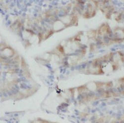 PLS1 Antibody - BSA Free, Novus Biologicals 100 &mu;g | Buy Online | Novus Biologicals | Fisher Scientific