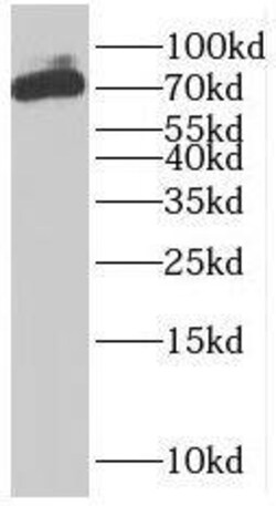 PLS1 Antibody - BSA Free, Novus Biologicals 100 &mu;g | Buy Online | Novus Biologicals | Fisher Scientific