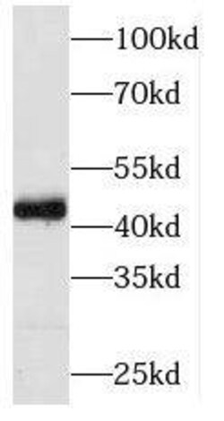 PIP5KL1 Antibody - BSA Free, Novus Biologicals 100 &mu;g | Buy Online | Novus Biologicals | Fisher Scientific