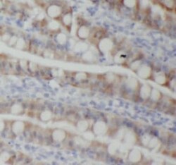 PIGZ Antibody - BSA Free, Novus Biologicals 100 &mu;g | Buy Online | Novus Biologicals | Fisher Scientific