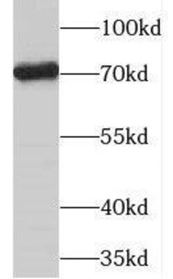 PGM2L1 Antibody - BSA Free, Novus Biologicals 100 &mu;g | Buy Online | Novus Biologicals | Fisher Scientific
