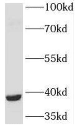 PGLYRP3/PGRPIA Antibody - BSA Free, Novus Biologicals 100 &mu;g | Buy Online | Novus Biologicals | Fisher Scientific